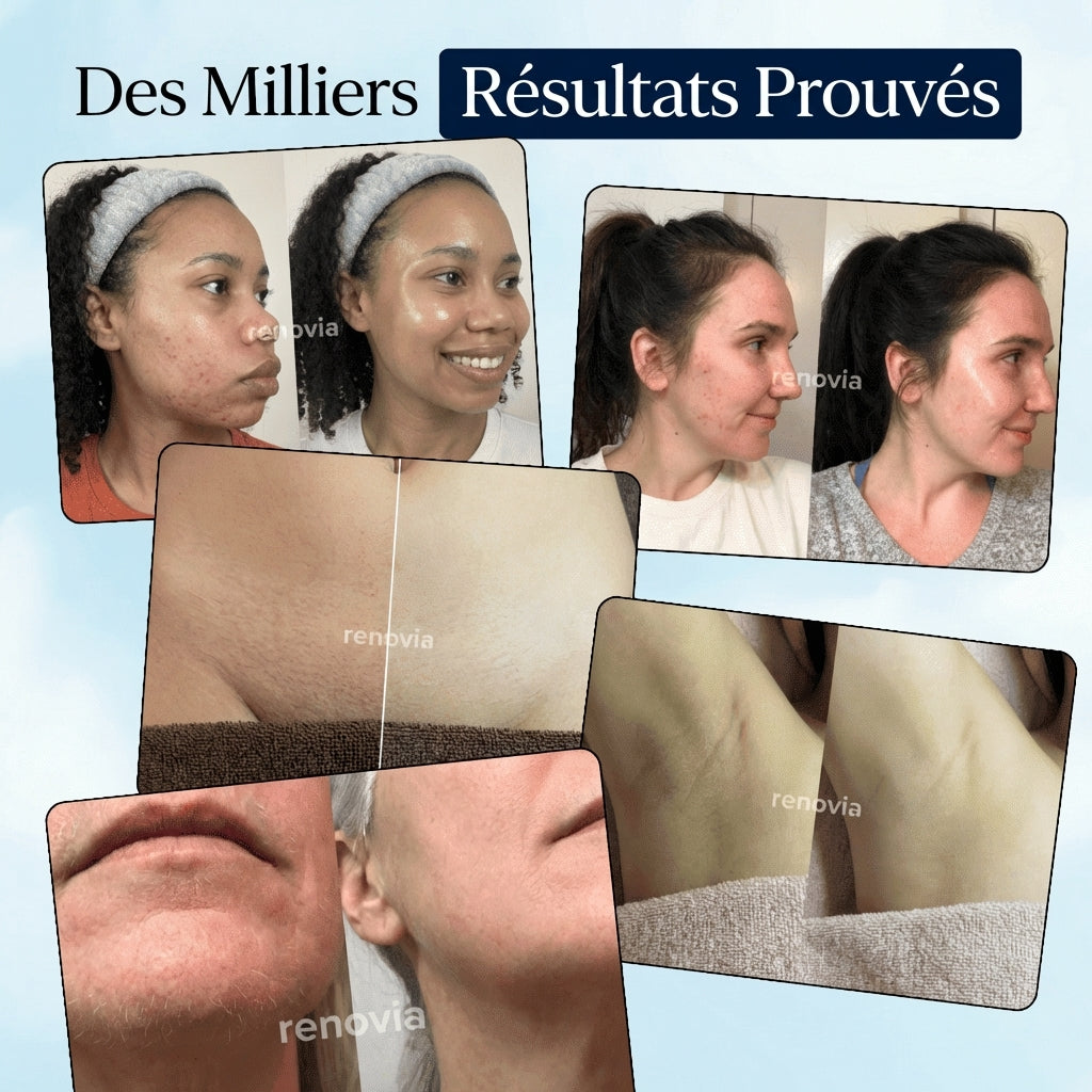 Renovia™